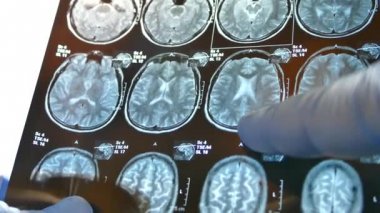 Doktor beyin x-ray ile görünüyor. Anlık görüntüsünü Mr kafa.