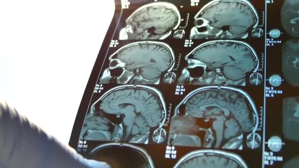 Il dottore guarda attraverso la radiografia del cervello. Istantaneo della risonanza magnetica della testa . — Video Stock
