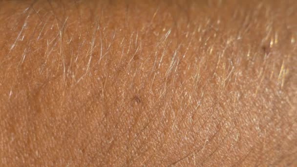 Corpo com pêlos na pele. Textura da mão humana close up — Vídeo de Stock