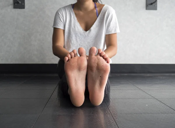 Bottom View Callused Feet — Stock Photo, Image