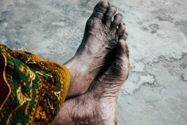 Bandipur Nepal 17 Ekim 2018 Closeup oturan bilinmeyen eski Nepal kadın ayak ön öğleden sonra Bandipur ana caddede yer alan geleneksel evi