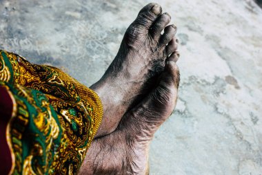 Bandipur Nepal 17 Ekim 2018 Closeup oturan bilinmeyen eski Nepal kadın ayak ön öğleden sonra Bandipur ana caddede yer alan geleneksel evi