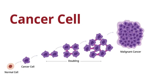 Cencer Cell Stage Proceso Desarrollo Vector — Vector de stock