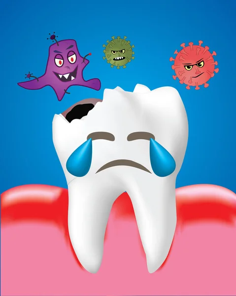 Caries Dental Con Bacterias Encías Inflamadas Concepto Cuidado Dental Ilustración — Archivo Imágenes Vectoriales