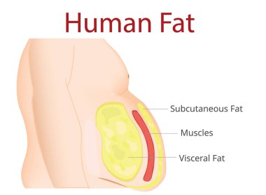 Egzersiz vücut yağ, Liposuction, diyet, cerrahi,