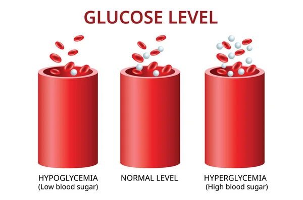 Livelli Glucosio Nei Vasi Sanguigni Livelli Normali Iperglicemia Livelli Elevati — Vettoriale Stock