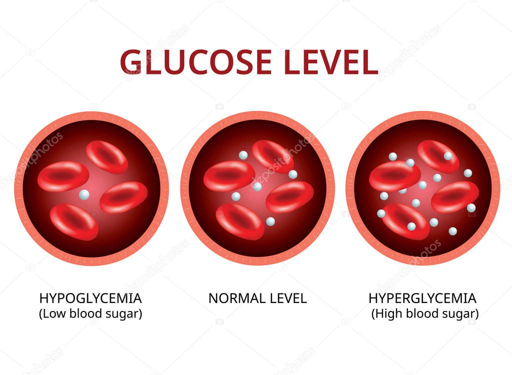 Glucose level in the blood vessel, normal level, hyperglycemia (high blood sugar), hypoglycemia (low blood sugar) Vector Illustration
