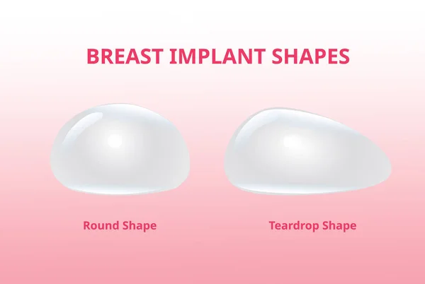 Implante mamario, forma de silicona, forma redonda y lágrima — Archivo Imágenes Vectoriales