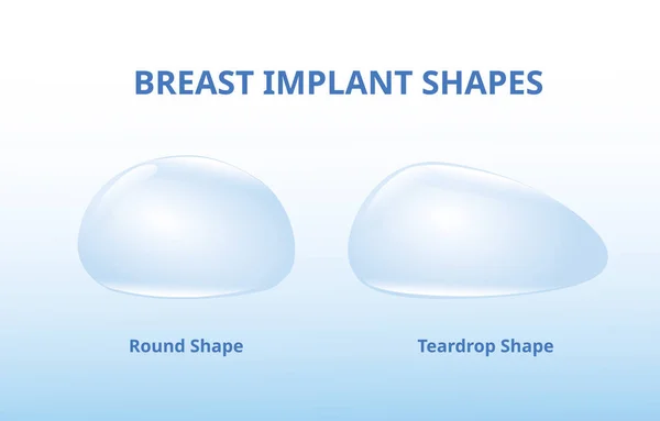 乳房インプラント、シリコーンの形、円形および涙滴 — ストックベクタ
