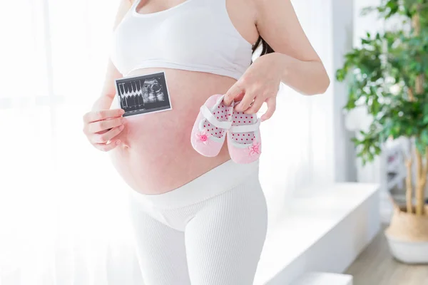 Frau Hält Baby Ultraschall Und Schuhe Zimmer — Stockfoto