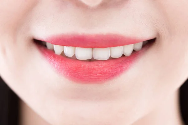 Close Beauty Asia Woman Tooth — Stock Photo, Image