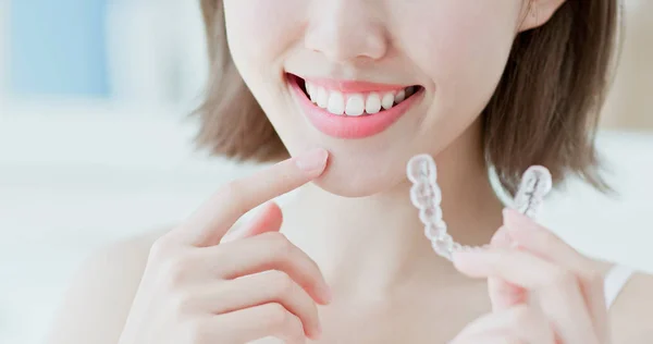 Primer Plano Mujer Sonriendo Felizmente Con Aparato Ortopédico Invisible — Foto de Stock