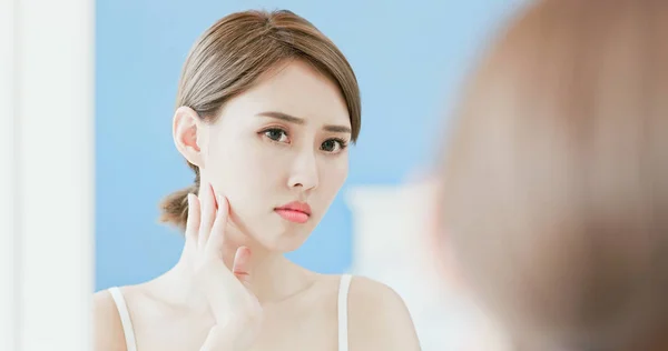 Vrouw Aanraken Van Haar Gezicht Met Acneprobleem — Stockfoto