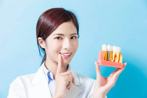 Dama Dentysta Pokaż Implantu Zęba Niebieskim Tle — Zdjęcie stockowe