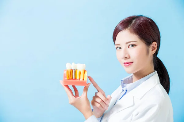 Dokter Gigi Wanita Menunjukkan Gigi Implan Pada Latar Belakang Biru — Stok Foto