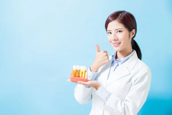 Mujer Dentista Tomar Diente Implante Pulgar Hacia Arriba Fondo Azul — Foto de Stock