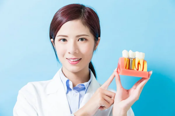 Dentista Mujer Muestran Diente Implante Fondo Azul — Foto de Stock