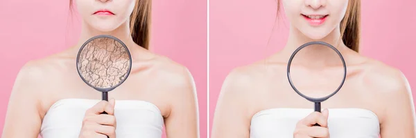 Mujer Tomar Lupa Cuello Con Piel Seca Concepto Cuidado Hidratante — Foto de Stock