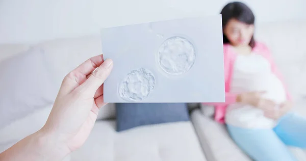 Μητέρα Δείχνουν Μια Εικόνα Του Δίδυμα Γονιμοποιημένο Ωάριο Μετά Από — Φωτογραφία Αρχείου