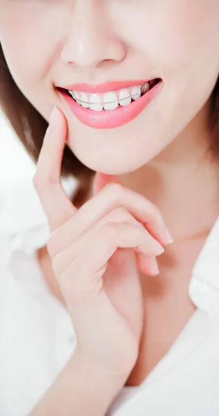 Close Beauty Woman Wear Retainer Teeth Smile You Stock Picture