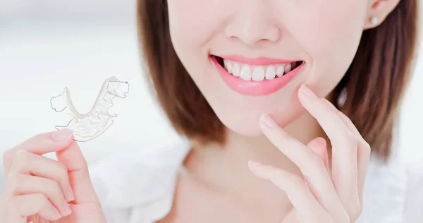 Bellezza Donna Sorridere Voi Con Supporto Denti — Foto Stock