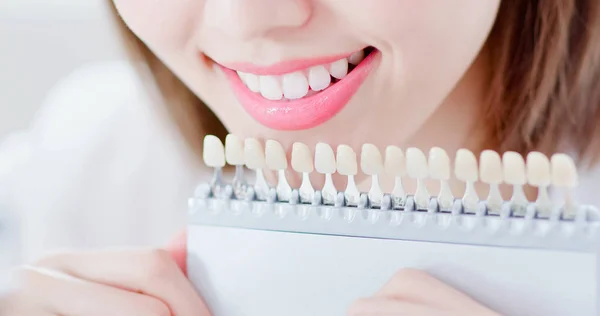 Close Beauty Woman Smile You Health Teeth Color Samples Tool — Stock Photo, Image