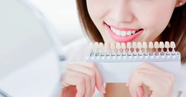 Zbliżenie Piękna Kobieta Uśmiech Zdrowia Zębów Kolor Narzędzia Próbki Bielenia — Zdjęcie stockowe