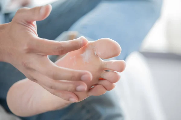 applying cream for athletes foot