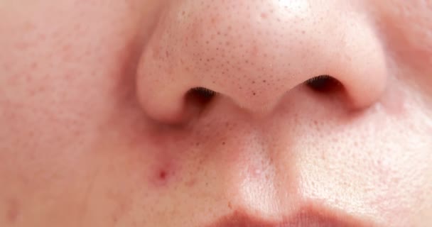 Blackheads on woman nose — Stock Video