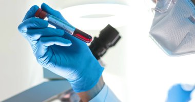 close up of microbiologist or medical worker hold blood test sample for the coronavirus covid-19 clipart