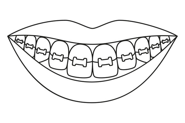 Line art black and white healthy smile in braces