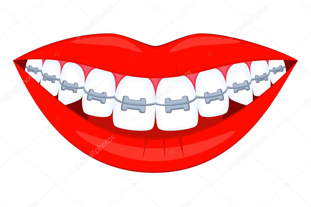 Colorful cartoon healthy smile in braces