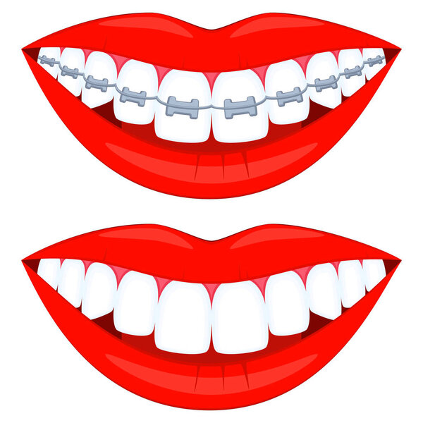 Colorful cartoon teeth aligning elements set
