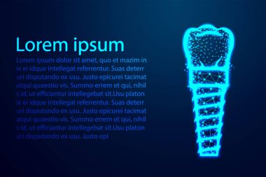 Diş implantı. Soyut düşük poli, Üçgen, nokta, çizgi, çokgen. Mavi arka planı parlat, Vektör çizimi