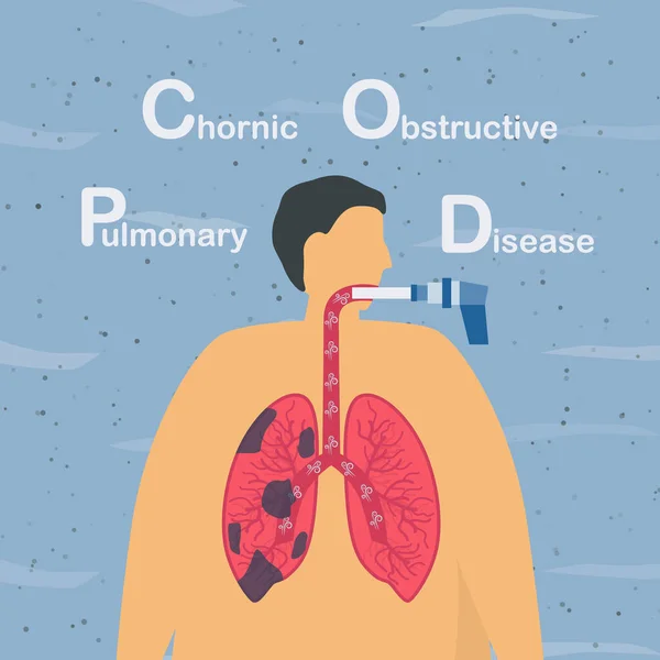 Spirometria Test Usato Misurare Funzione Polmonare Malattia Polmonare Ostruttiva Cronica — Vettoriale Stock