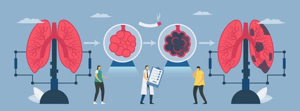 Maladie Pulmonaire Obstructive Chronique Mpoc Transformation Poumon Normal Mauvais Poumon — Image vectorielle