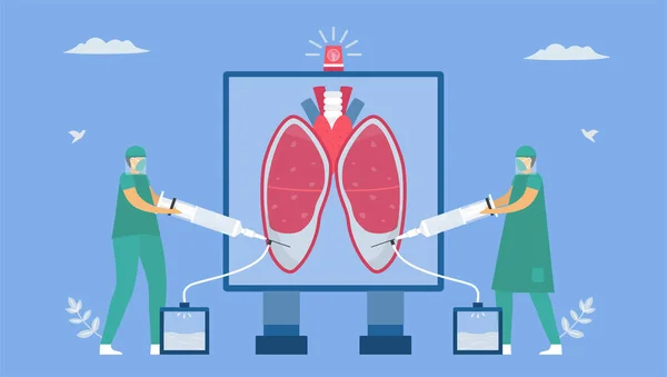 Épanchement Pleural Est Collecte Excès Liquide Entre Les Couches Plèvre — Image vectorielle