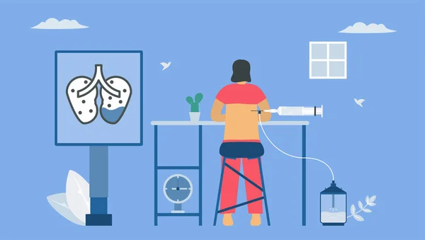 Épanchement Pleural Est Collecte Excès Liquide Entre Les Couches Plèvre — Image vectorielle