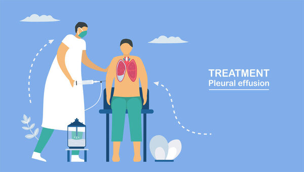 Pleural effusion is collection of excess fluid between layers of pleura outside lungs. Pulmonology vector illustration about restrictive lung disease.