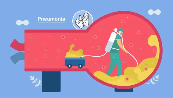 Θεραπεία Και Καθαρές Κυψελίδες Πνευμονία Είναι Λοίμωξη Που Προκαλεί Φλεγμονές — Διανυσματικό Αρχείο