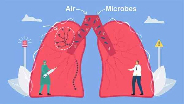 肺炎の診断および治療薬 この症状は微生物によって引き起こされます 肺疾患に関する肺腫瘍学ベクトル図 — ストックベクタ