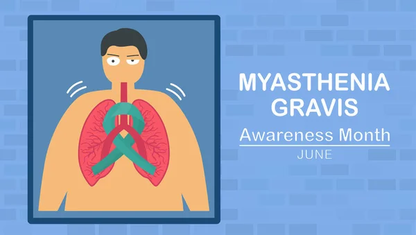 Myasthenia gravis kas güçsüzlüğüne yol açan nöromüsküler bir hastalıktır. Bunlara göz, yüz ve yutkunma da dahil. Kısıtlayıcı akciğer hastalığıyla ilgili Pulmonoloji vektör çizimi.