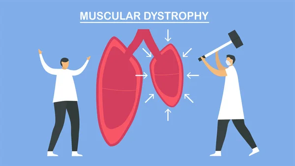 Dystrofia Mięśniowa Choroby Powodujące Osłabienie Utratę Masy Mięśniowej Ilustracja Wektora — Wektor stockowy