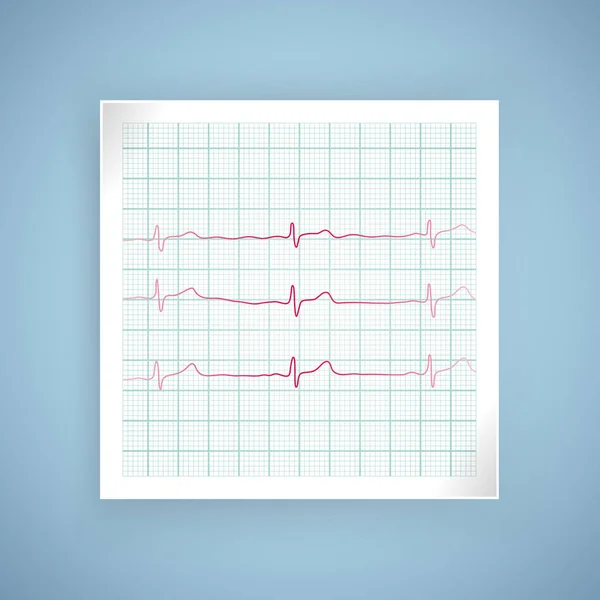 Gráfico do pulso cardíaco. Batimento cardíaco do ECG no monitor. Cuidados de saúde, ilustração vetorial — Vetor de Stock