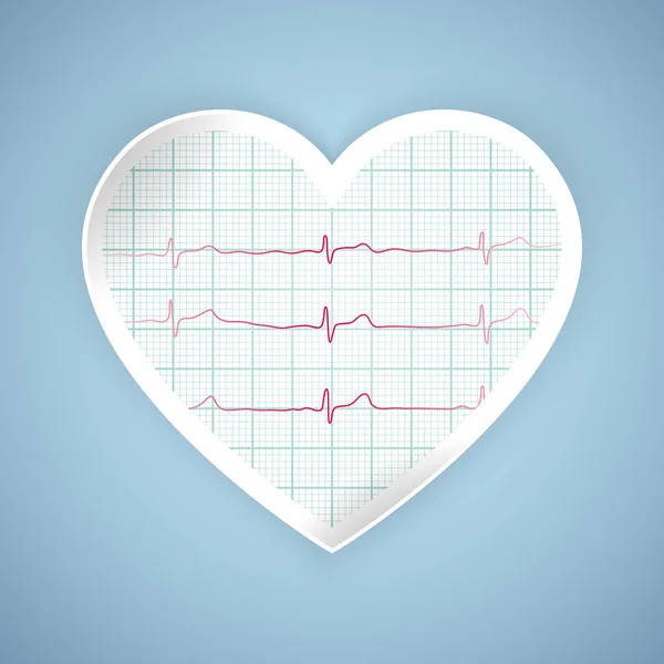 Пульс сердца графический. Сердцебиение ЭКГ на мониторе. Здравоохранение, векторная иллюстрация — стоковый вектор
