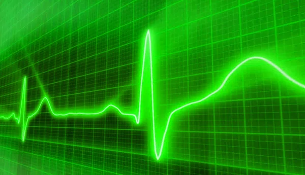 Hart Klopt Groene Cardiogram — Stockfoto