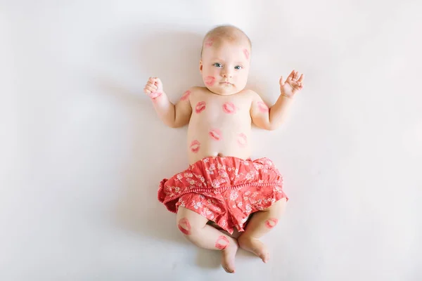 Εικόνα Των Αξιολάτρευτο Παιδί Κόκκινο Φιλιά Στο Δέρμα Ευτυχισμένο Μωρό — Φωτογραφία Αρχείου