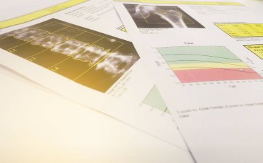 Yumuşak ve bulanık görüntü: kemik yoğunluğu kalça ve lumbarspine sonuç osteoporoz .bir parlak arka plan