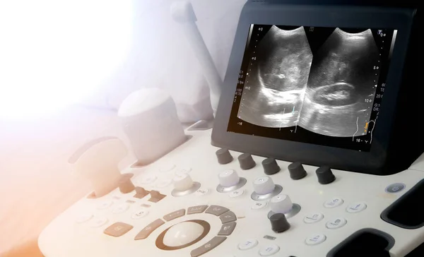 Tıbbi ekipman arka planı, yakın çekim ultrason makinesi. — Stok fotoğraf