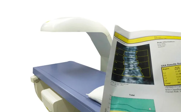 Special examination lumbar spine bone density.too blurriness and artifacting image. — Stock Photo, Image